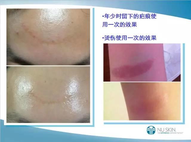 NU SKIN 肌肤修护精华露