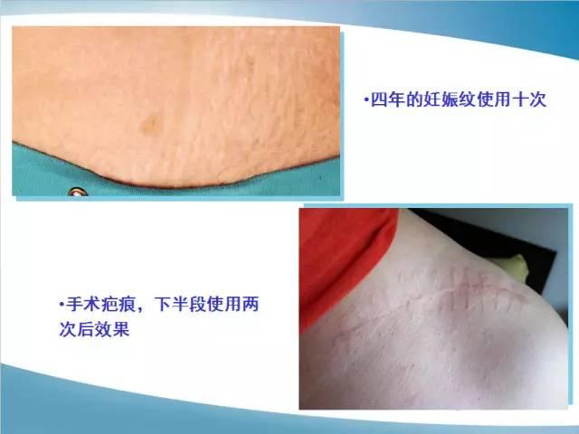 NU SKIN 肌肤修护精华露